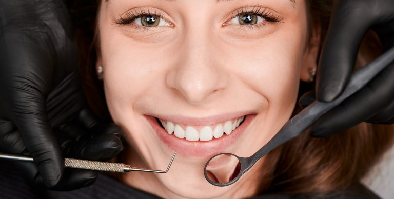 perfect smile makeover