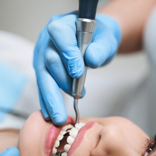 Young woman is lying in dental chair and being treated by dentist using mirror and drill